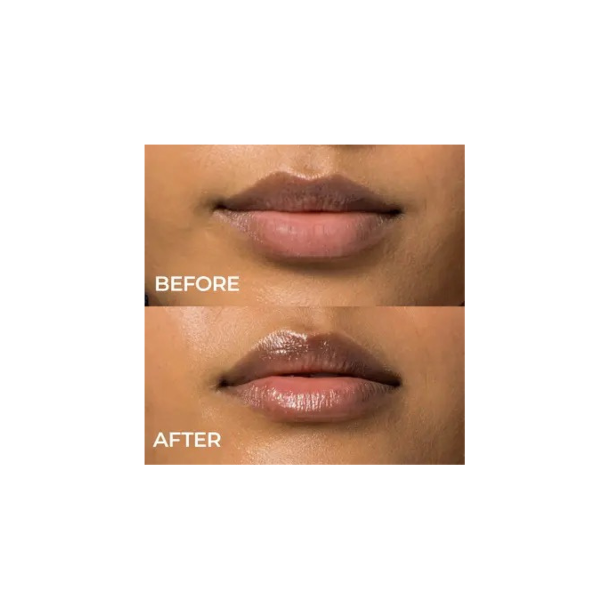 Lip Remedy Mask